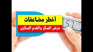 أخطر مضاعفات مرض السكر والقدم السكرى | الاحصائيات العالمية لمرض السكر والقدم السكرى