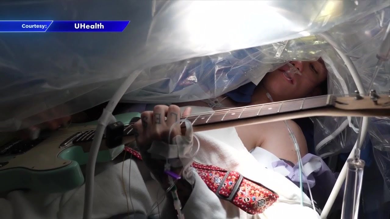 Man plays guitar while undergoing brain surgery at Sylvester Comprehensive Cancer Center