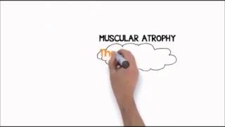 50 Off  Truth About Cellulite Joey Atlas, Naked Beauty the Symulast Method Review Cellulite Removal