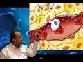 Inflammation 4 ( cellular events : chemotaxis , phagocytosis ) Dr. Sameh Ghazy