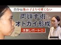 【自分は可愛くないから人前でマスクを外せない】口元の突出で悩んでいる20代女性の術前インタビュー①