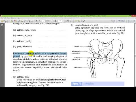 فيديو: ماذا تعني كلمة spondylalgia؟