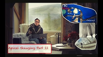 Apical Gauging Large Anterior Teeth Thank you 50K Subscribers!!!