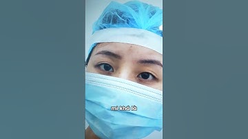 Cắt mí nhẹ nhàng hơn nhấn mí là có thật | Bs Hùng Thanh -  Thẩm Mỹ GN