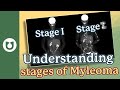 How do i know the stage of my myeloma