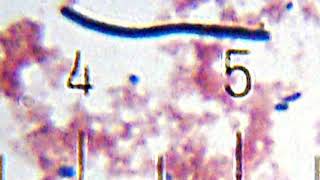 Lactobacillus delbrueckii subsp. bulgaricus | Wikipedia audio article