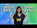 Diferencia entre Carillas Dentales y Coronas Dentales l Demostración