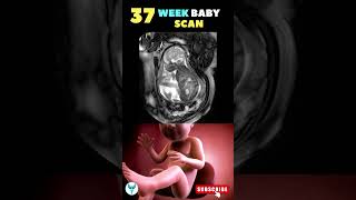 37 weeks baby scan  ️ 37 weeks fetus  Fetal development #shortsfeed #pregnancy