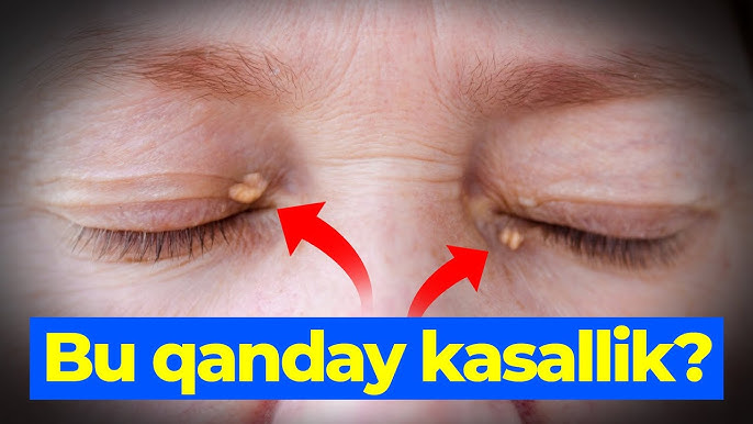 Vagina atrofida oq doglar