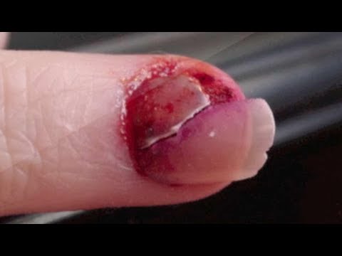 Beleza das unhas