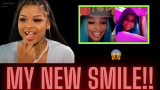 Chrisean Rock Shows Off Her New Smile Teeth While In Paris MUST SEE