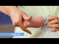 How to do Clubfoot Stretches - Nemours KidsHealth