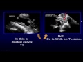 Imaging the Cervix in Pregnancy Helpful Hints