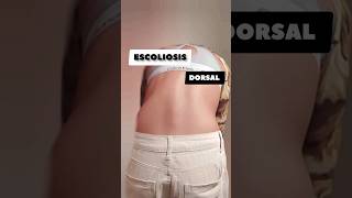 Escoliosis Dorsal