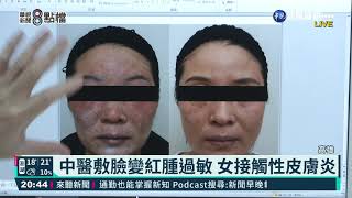 中醫敷臉變紅腫過敏 女接觸性皮膚炎|華視新聞 20210311 中醫敷臉變紅腫過敏 女接觸性皮膚炎|華視新聞 20210311