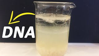 How To Extract DNA From Banana At Home