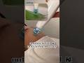 Does derma plasma really work?