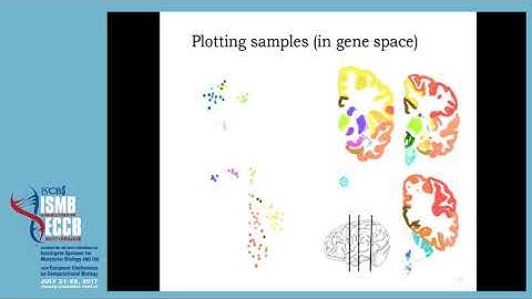 BrainScope: interactive visual exploration of... - Sjoerd M. H. Huisman - BioVis - ISMB/ECCB 2017