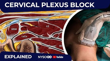 Cervical Plexus Block - Regional anesthesia Crash course with Dr. Hadzic