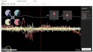 Blackbox Log Analysis: brolio 10/25