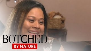 Botched by Nature | Lightning Strike Causes Incredible Problems | E! Botched by Nature | Lightning Strike Causes Incredible Problems | E!