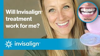 Will Invisalign® treatment work for me? | Invisalign