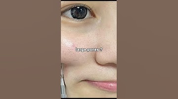 you Want This Clear Skin 🤗#skincare #koreanbeauty #glowup #beauty #shorts