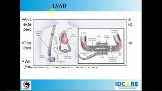 LVAD Infections