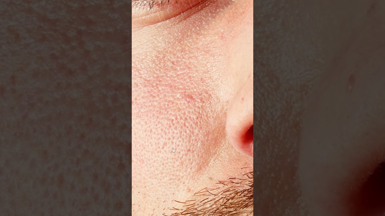 preview_player