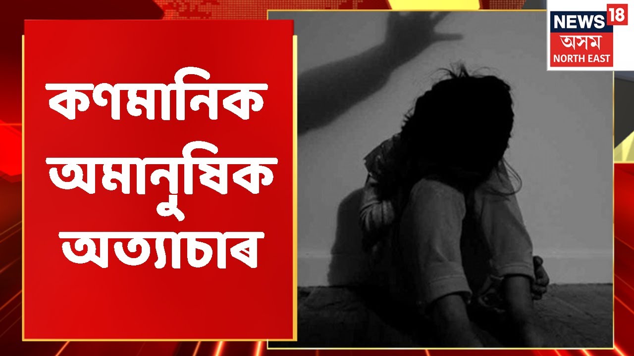 Child Abuse Incident Sivasagar / বন কৰিবলৈ অমান্তি হ'লে কৰিছিল অমানুষিক অত্যাচাৰ Assam News / crime