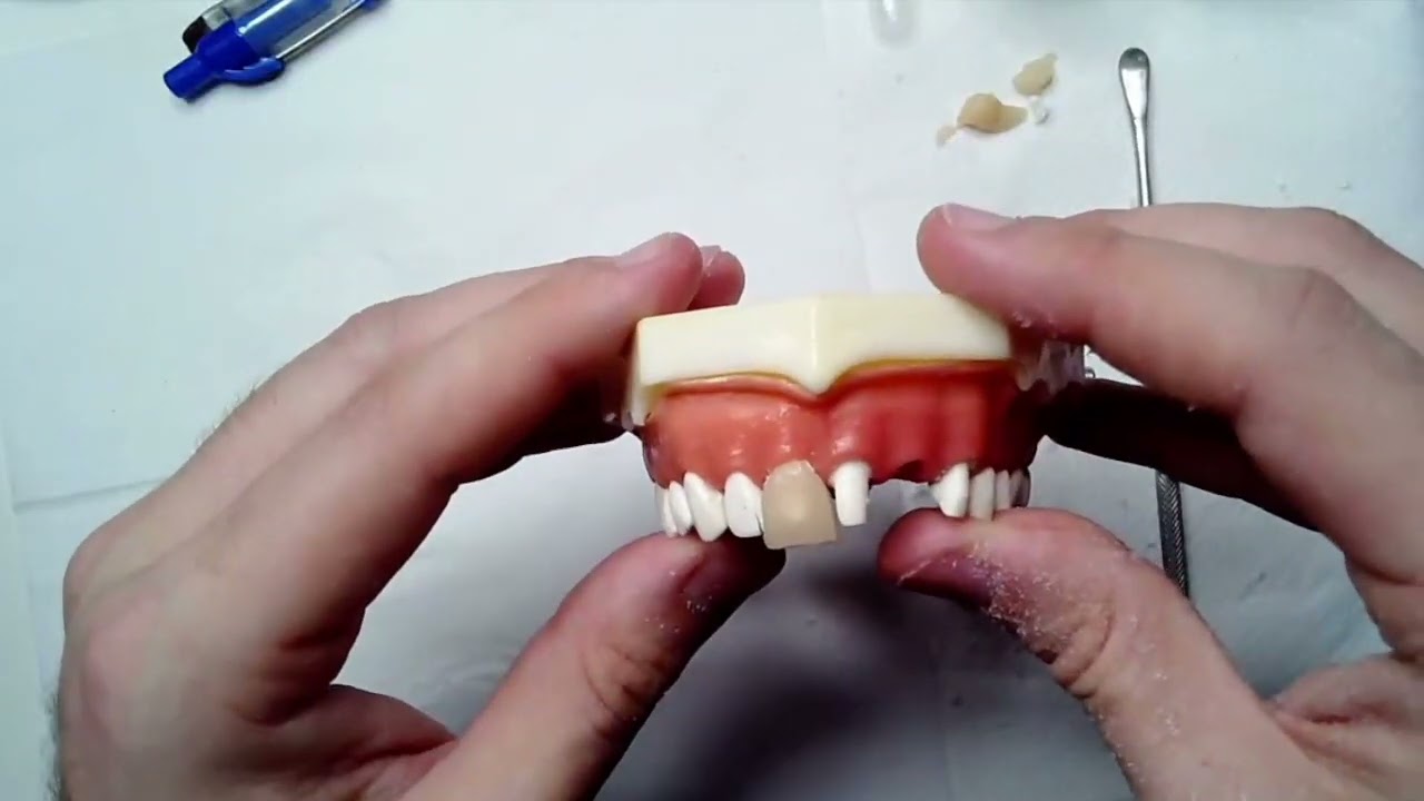 Prof. Leonardo Colombo Zeidan: provisorios -  técnica da bolinha