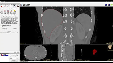 Analyze 14.0 - Segment: Spline Trace