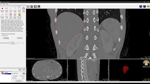Analyze 14.0 - Segment: Spline Trace
