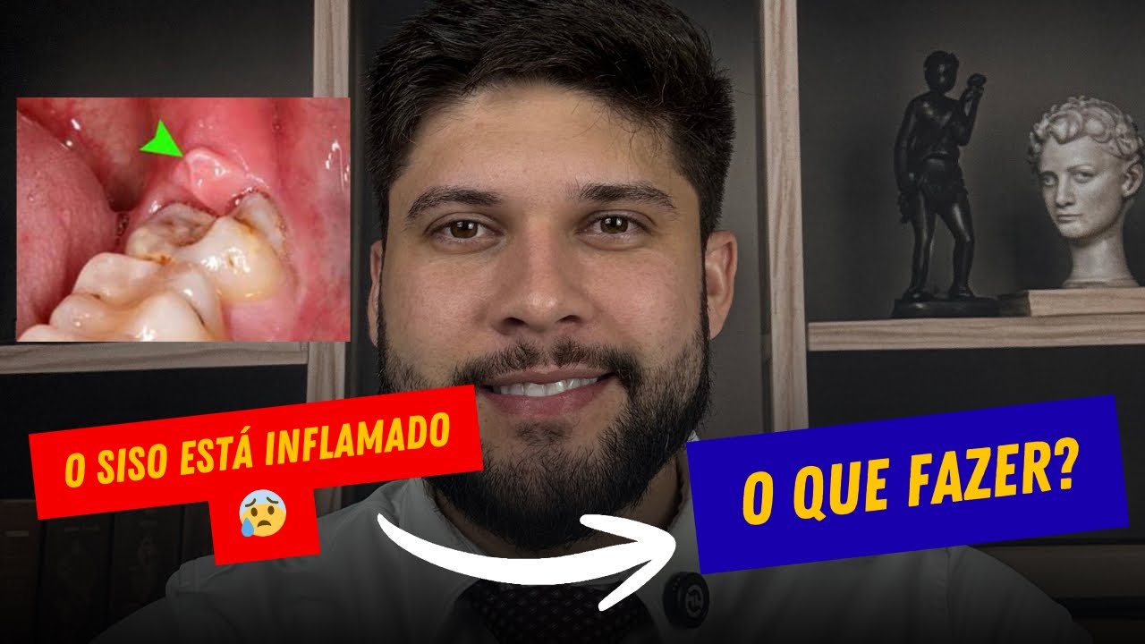 SISO INFLAMADO E AGORA? | RESOLVER EM CASA?