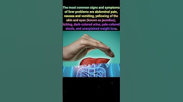 How to understand that you have liver problems? #health #wealth #body #liver #shorts