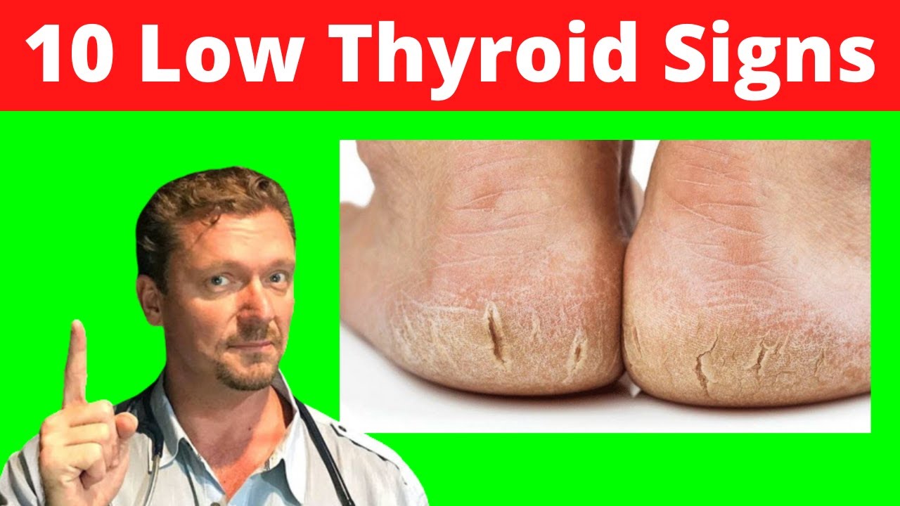 Pin on thyroid health