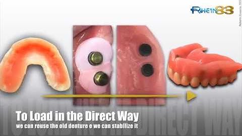 Ot Equator Smartbox Rhein83 DDS Roberto Scrascia