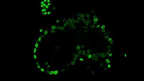 healthy endometrial organoid z-stack