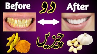 Natural Way to Whiten Teeth at Home in 2 minutes ||  How to Whiten Your Teeth Naturally