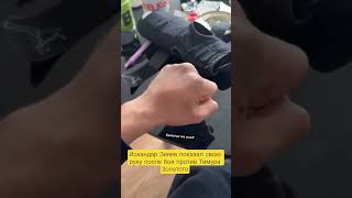 Искандар Зияев показал свою руку после боя против Тимура Золотого