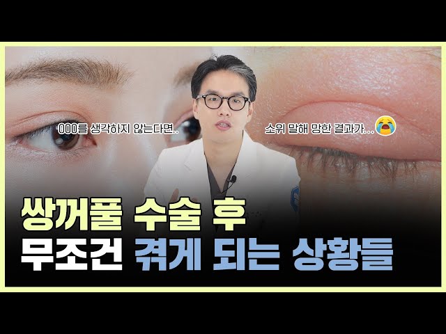 쌍꺼풀 수술 후에 '이 상황'은 무조건 겪게 됩니다!