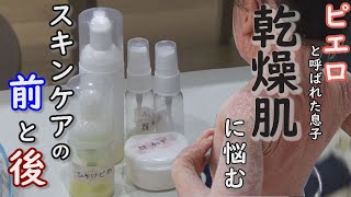 保湿は続けなければなりません 幼稚園に持参する5つの容器の中身は 道化師様魚鱗癬定期配信型ドキュメンタリー 第14話 Youtube 保湿は続けなければなりません 幼稚園に持参する5つの容器の中身は 道化師様魚鱗癬定期配信型ドキュメンタリー 第14話 Youtube