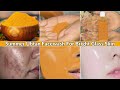 ₹5 में Ubtan Facewash-5 min में चेहरे का मैल कालापन साफ़-Remove Tan,Clear Spots-Get Bright Glass Skin