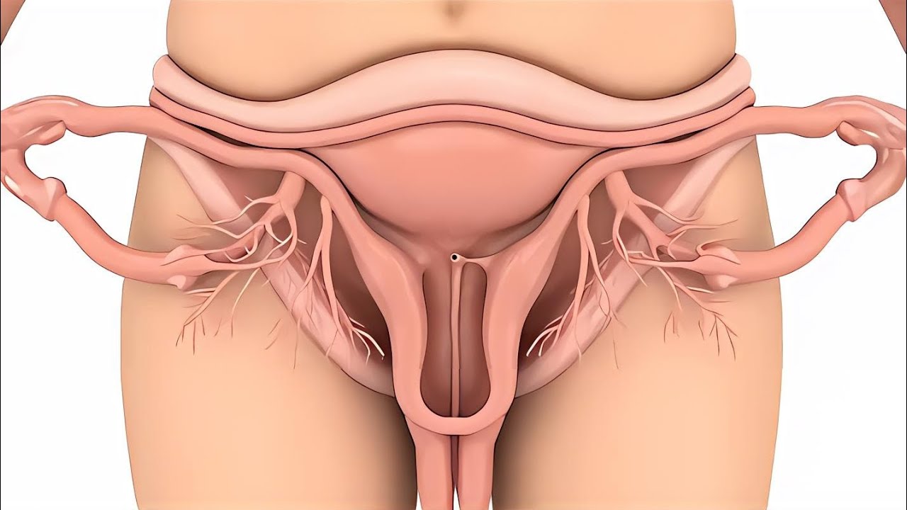 White Discharge period First day painfull process inside view 