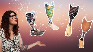 How To Personalize A Prosthetic Socket