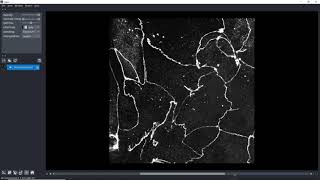 Learn the basics of Napari image viewer for Python