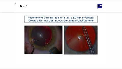 Video 3  ZEISS eCademy   MED   miLOOP introduction E Learning  MED   miLOOP Step by Step