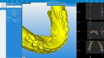 RealGUIDE Software: Import Double Scan (Dual Scan Protocol-DSP)