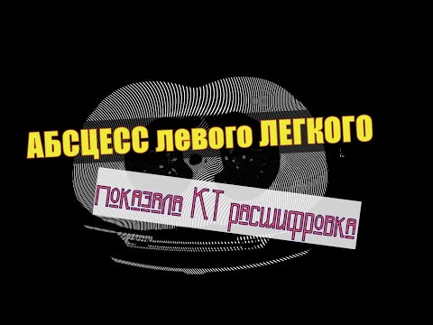 Диагностика АБСЦЕССА ЛЕГКОГО, симптомы и признаки заболевания на РАСШИФРОВКЕ КТ грудной полости