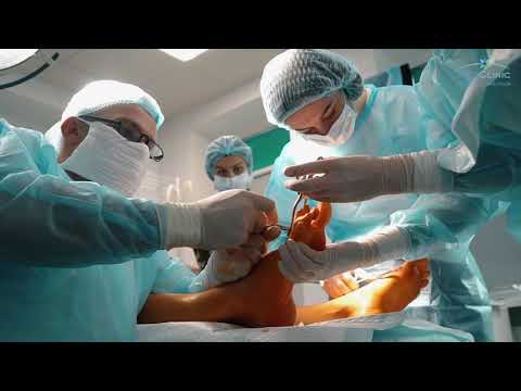 Вальгусна деформація стопи • Травмотологія MedClinic